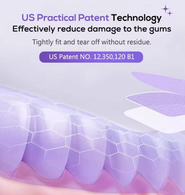 HUUMN Whitening strips